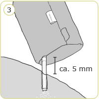 Eine Kissenhülle von Theraline wird mit einem Reißverschluss leicht geöffnet, während Füllmaterial mit einem Abstand von ca. 5 mm aus einer Röhre eingeführt wird. Texthinweis: \